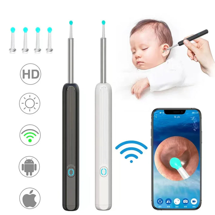 Wireless Smart Ear Cleaner with 1296P Camera & Visual Endoscope for Ear Care