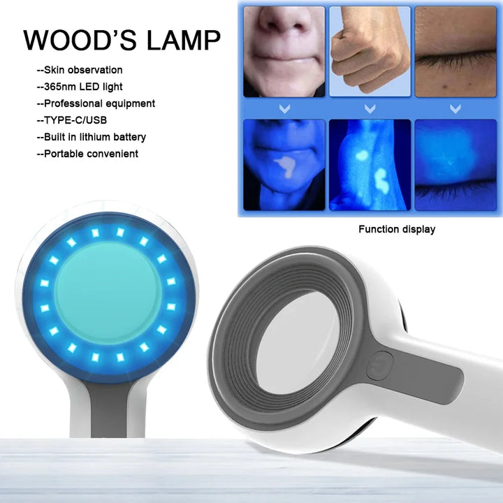 UV Facial Skin Analyzer with 16 LED Lens for Diagnosis & Care